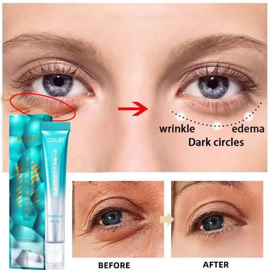 Crème Rafraîchissante pour les Yeux - contre les Cernes